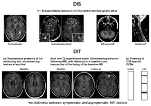 Criteria for dissemination in space and dissemination in time in a patient with clinically isolated syndrome (a) a simultaneous presence of gadolinium-enhancing and non-enhancing lesions at any time, (b) a new T2-hyperintense and/or gadolinium-enhancing lesion on a follow-up MRI scan, with reference to a baseline scan, irrespective of timing of baseline of the MRI, or (c) Presence of cerebrospinal fluid-specific oligoclonal bands (lower row)