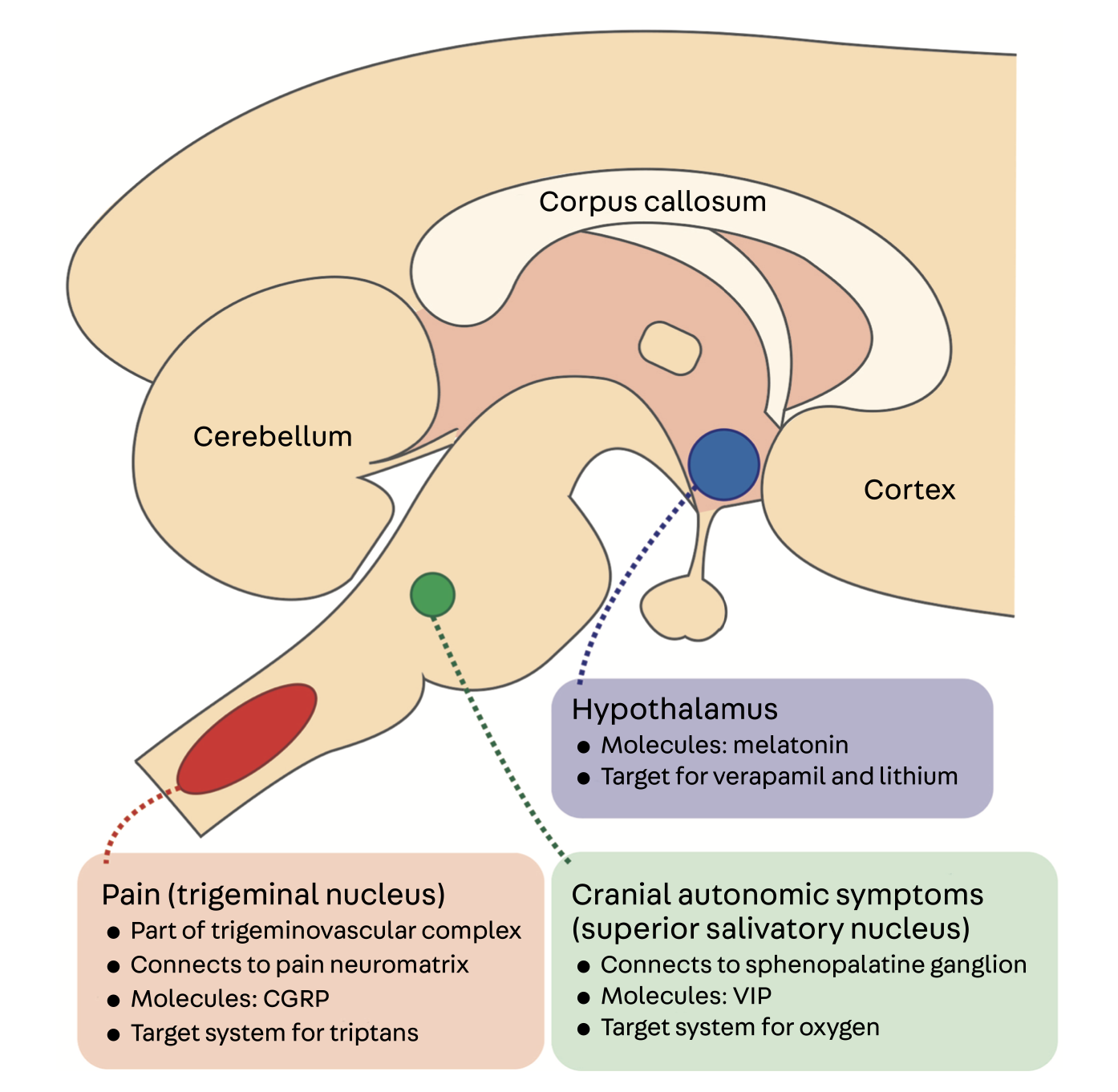 Cluster Headache Neuropedia