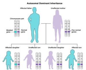 Figure (2): Autosomal dominant inheritance pattern in HD.