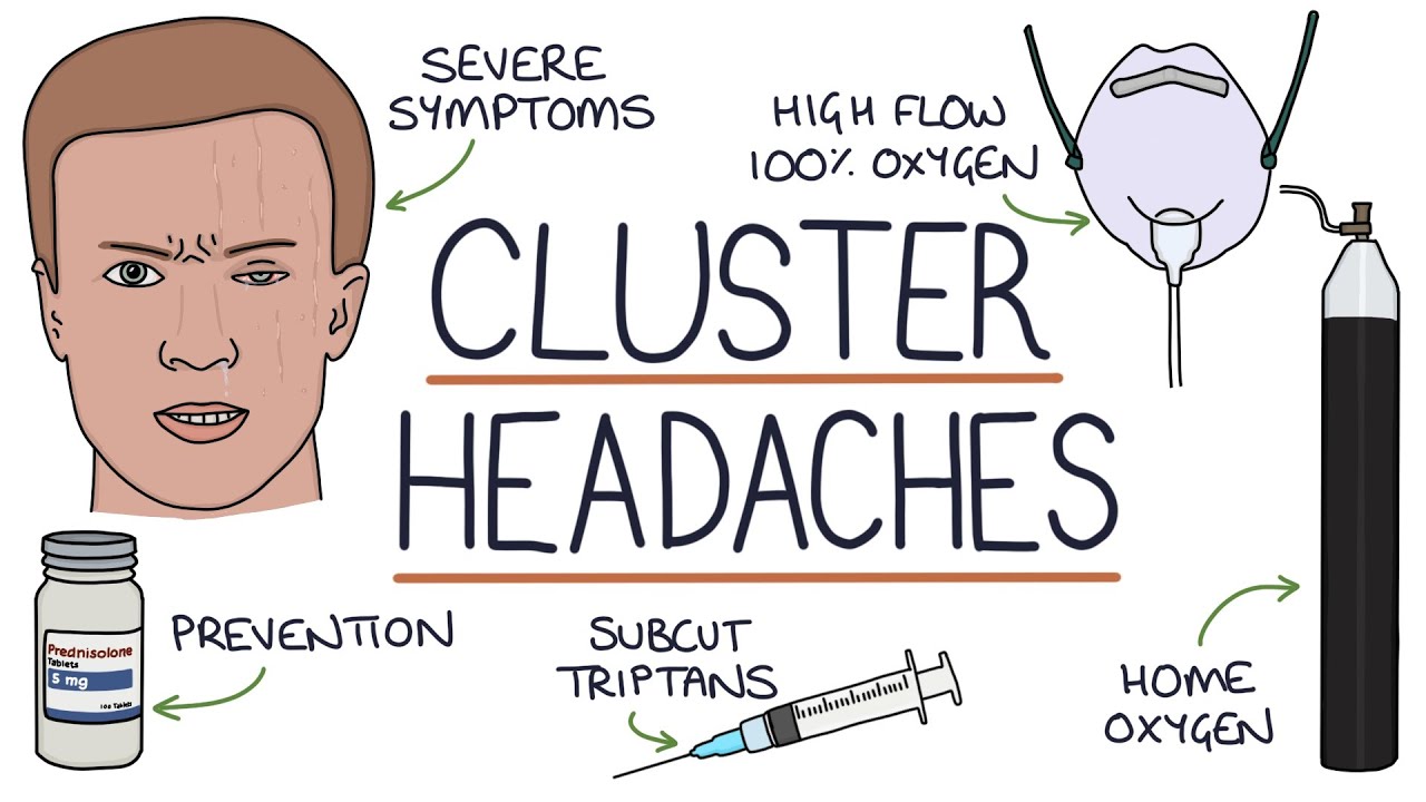 Cluster Headache Neuropedia