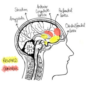 Figure 1.  this figure represents increased activity in the emotional center of the brain – the amygdala and increased activation of the reward network striatum and orbital frontal cortex fails to, self-control and planning network frontal cortex and anterior cingulate cortex remain underactive. 22
