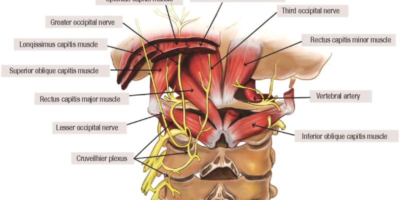 Occipital Neuralgia Neuropedia Occipital Neuralgia Neuropedia