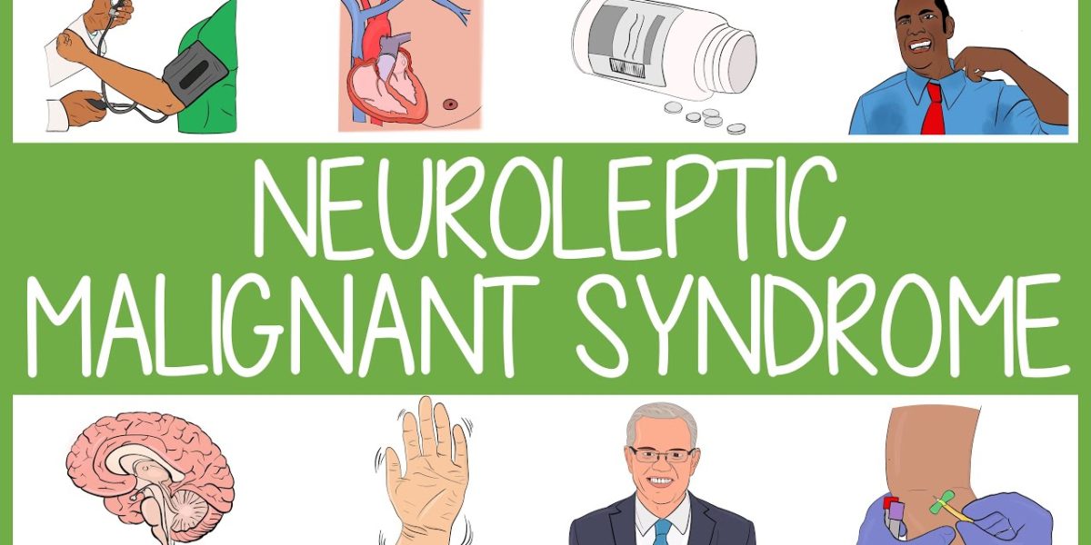 Neuroleptic Malignant Syndrome - Neuropedia