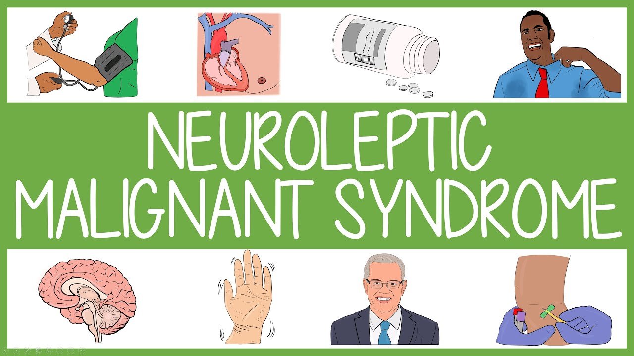 Neuroleptic Malignant Syndrome MEDizzy, 55% OFF