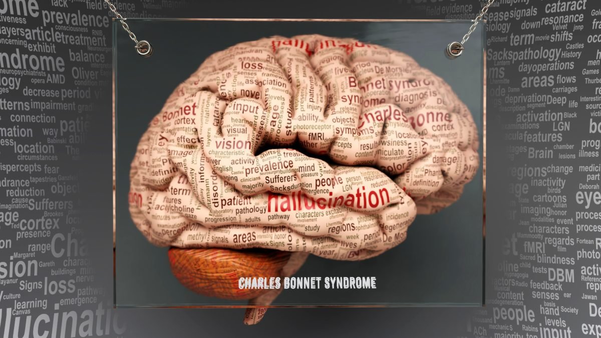 Charles Bonnet syndrome is a visual hallucination caused by the brain adapting to significant vision loss.