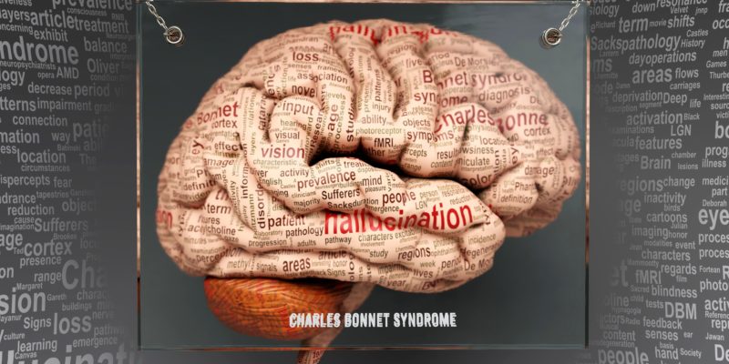 Charles Bonnet syndrome is a visual hallucination caused by the brain adapting to significant vision loss.