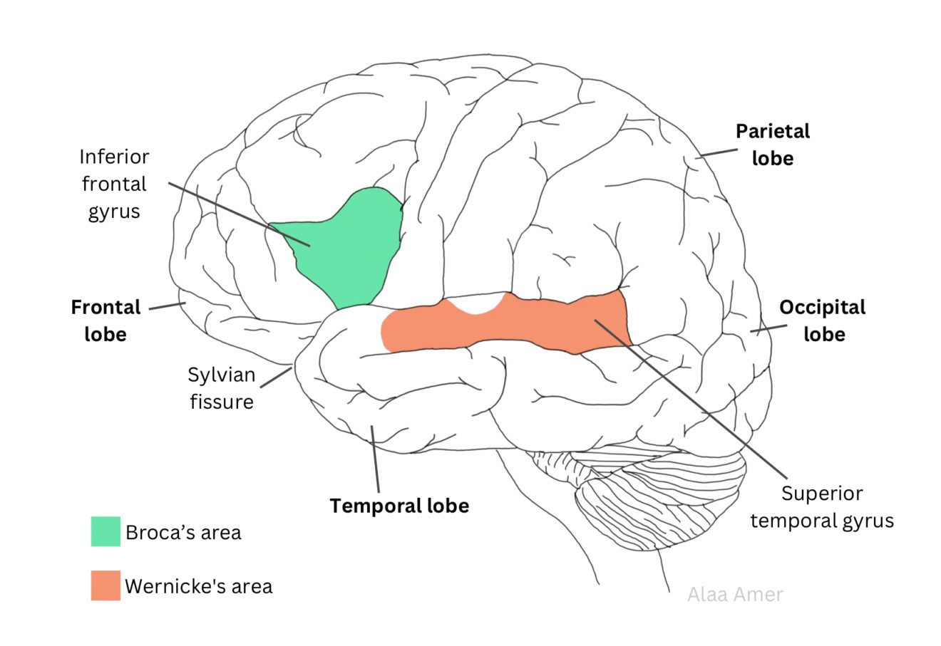 Aphasia - Neuropedia