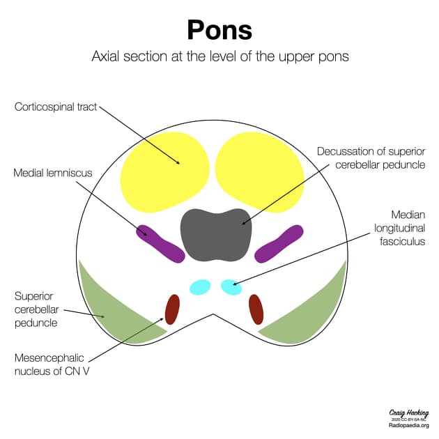  Axial section at the level of the upper pons [13].