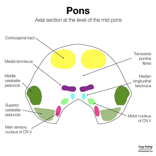  Axial section at the level of the middle pons [13].