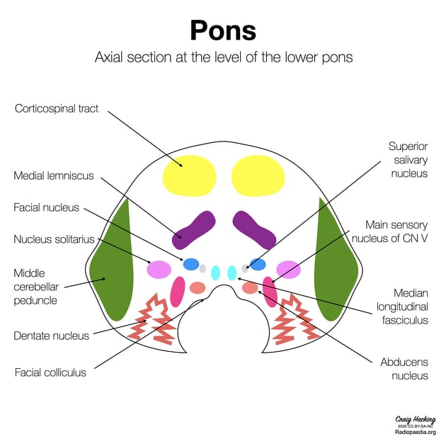 Axial section at the level of the lower pons [13].